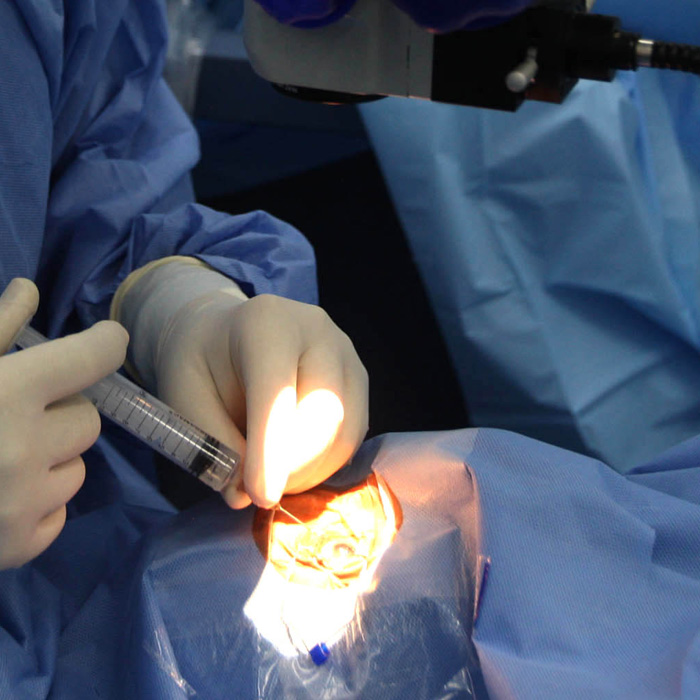 Cirurgias oftalmológicas nas diversas especialidades